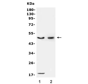 Western blot testing of human 1) HepG2 and 2) K562 cell lysate with CD46 antibody. Observed molecular weight: 41~70 kDa depending on glycosylation level.