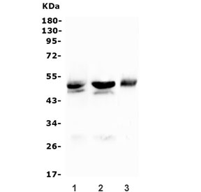 Western blot testing of 1) rat liver, 2) mouse liver and 3) mouse Neuro-2a lysate with CD46 antibody. Observed molecular weight: 41~70 kDa depending on glycosylation level.