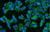 Immunofluorescent staining of FFPE human T-47D cells with CD46 antibody (green) and DAPI nuclear stain (blue). HIER: steam section in pH6 citrate buffer for 20 min.