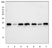 Flow cytometry testing of human A549 cells with NM23 antibody at 1ug/10^6 cells (blocked with goat sera); Red=cells alone, Green=isotype control, Blue=NM23 antibody.