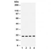 Western blot testing of 1) rat brain, 2) rat liver, 3) human HeLa and 4) mouse NIH3T3 lysate with NM23 antibody. Expected molecular weight: 17/20 kDa (NM23-H1A/-H1B).