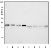 Western blot testing of 1) rat brain, 2) rat liver, 3) rat lung, 4) rat C6, 5) mouse brain, 6) mouse liver, 7) mouse lung and 8) mouse NIH 3T3 cell lysate with NM23 antibody. Expected molecular weight: 17/20 kDa (NM23-H1A/-H1B).