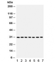 Western blot testing of 1) rat liver, 2) rat lung, 3) human HeLa, 4) A549, 5) MM231, 6) SW620 and 7) 22RV1 with NQO1 antibody. Predicted/observed molecular weight ~30 kDa.