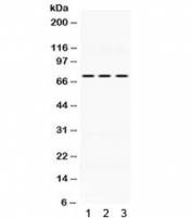 Western blot testing of mouse 1) lung, 2) spleen, 3) testis lysate with IL2RB antibody. Expected molecular weight ~61 kDa (unmodified), 70-75 kDa (glycosylated).