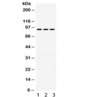 Western blot testing of human 1) HeLa, 2) SGC and 3) SW620 cell lysate with PRLR antibody. Expected molecular weight: 70-117 kDa depending on glcosylation level.