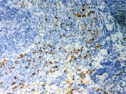 IHC staining of FFPE rat spleen tissue with CD36 antibody. HIER: Boil the paraffin sections in pH 6, 10mM citrate buffer for 20 minutes and allow to cool prior to staining.