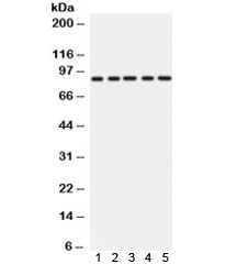 Western blot testing of 1) rat liver, 2) rat heart, 3) mouse liver, 4) mouse heart and 5) human SMCC lysate with CD36 antibody. Expected molecular weight: ~53/88 kDa (unmodified/glycosylated).~