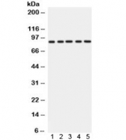 Western blot testing of 1) rat liver, 2) rat heart, 3) mouse liver, 4) mouse heart and 5) human SMCC lysate with CD36 antibody. Expected molecular weight: ~53/88 kDa (unmodified/glycosylated).
