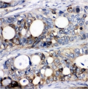 IHC testing of FFPE mouse testis with Stathmin 1 antibody. HIER: Boil the paraffin sections in pH 6, 10mM citrate buffer for 20 minutes and allow to cool prior to staining.