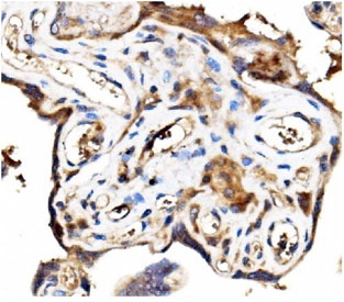 IHC testing of FFPE human placental tissue with Stathmin 1 antibody. HIER: Boil the paraffin sections in pH 8 EDTA for 20 minutes and allow to cool prior to staining.