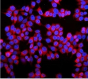 Immunofluorescent staining of FFPE human MCF-7 cells with Stathmin 1 antibody (red) and DAPI nuclear stain (blue). HIER: steam section in pH6 citrate buffer for 20 min.