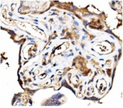 IHC testing of FFPE human placental tissue with Stathmin 1 antibody. HIER: Boil the paraffin sections in pH 8 EDTA for 20 minutes and allow to cool prior to staining.