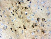 IHC testing of FFPE mouse brain tissue with Stathmin 1 antibody. HIER: Boil the paraffin sections in pH 8 EDTA for 20 minutes and allow to cool prior to staining.