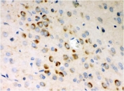 IHC testing of FFPE rat brain tissue with Stathmin 1 antibody. HIER: Boil the paraffin sections in pH 8 EDTA for 20 minutes and allow to cool prior to staining.