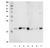 Western blot testing of 1) rat brain, 2) rat testis, 3) mouse brain, 4) mouse testis, 5) human MDA-MB-453, 6) human SH-SY5Y and 7) human Raji lysate with Stathmin 1 antibody. Expected molecular weight ~17 kDa.