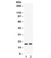 Western blot testing of 1) mouse ovary and 2) mouse HEPA lysate with IP10 antibody.  Expected molecular weight 8~11 kDa, observed here at ~19 kDa.