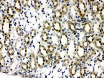 IHC testing of FFPE rat kidney wtih PTPN2 antibody. HIER: Boil the paraffin sections in pH 6, 10mM citrate buffer for 20 minutes and allow to cool prior to staining.
