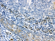 IHC testing of FFPE human tonsil with XBP1 antibody. HIER: Boil the paraffin sections in pH 6, 10mM citrate buffer for 20 minutes and allow to cool prior to staining.