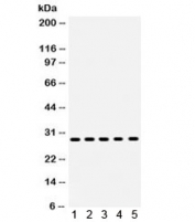 Western blot testing of human 1) MCF7, 2) MM231, 3) MM453, 4) SKOV and 5) HeLa lysate with XBP1 antibody. Expected/observed molecular weight ~29/40 kDa (isoform 1/2).