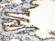 IHC testing of FFPE rat lung with XBP1 antibody. HIER: Boil the paraffin sections in pH 6, 10mM citrate buffer for 20 minutes and allow to cool prior to staining.