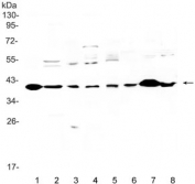 Western blot testing of 1) rat heart, 2) rat brain, 3) rat liver, 4) rat PC-12, 5) human U-87 MG, 6) mouse kidney, 7) mouse heart and 8) mouse brain lysate with IGFBP3 antibody. Expected molecular weight: 31-44 kDa depending on level of gylcosylation.