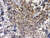 IHC testing of FFPE mouse spleen with PU.1 antibody. HIER: Boil the paraffin sections in pH 6, 10mM citrate buffer for 20 minutes and allow to cool prior to staining.