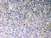 IHC testing of FFPE human tonsil with PU.1 antibody. HIER: Boil the paraffin sections in pH 6, 10mM citrate buffer for 20 minutes and allow to cool prior to staining.