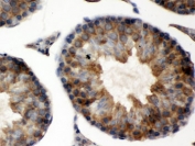 IHC testing of FFPE mouse testis with TCP1 alpha antibody. HIER: Boil the paraffin sections in pH 6, 10mM citrate buffer for 20 minutes and allow to cool prior to staining.