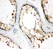 IHC staining of FFPE human testis tissue with TCP1 alpha antibody. HIER: boil tissue sections in pH8 EDTA for 20 min and allow to cool before testing.