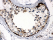 IHC testing of FFPE human testis with TCP1 alpha antibody. HIER: Boil the paraffin sections in pH 6, 10mM citrate buffer for 20 minutes and allow to cool prior to staining.