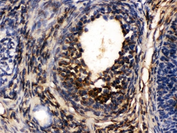 IHC testing of FFPE rat ovary with TCP1 alpha antibody. HIER: Boil the paraffin sections in pH 6, 10mM citrate buffer for 20 minutes and allow to cool prior to staining.