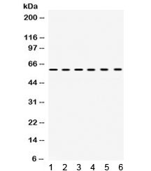 Western blot testing of 1) rat brain, 2) rat testis, 3) mouse spleen, 4) mouse thymus, 5) human HeLa, 6) human MCF7 lysate with TCP1 alpha antibody. Expected/observed molecular weight ~60 kDa.