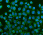 Immunofluorescent staining of FFPE human Caco-2 cells with TCP1 alpha antibody (green) and DAPI nuclear stain (blue). HIER: steam section in pH6 citrate buffer for 20 min.