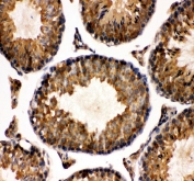 IHC staining of FFPE mouse testis tissue with TCP1 alpha antibody. HIER: boil tissue sections in pH8 EDTA for 20 min and allow to cool before testing.