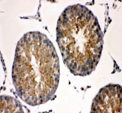 IHC staining of FFPE rat testis tissue with TCP1 alpha antibody. HIER: boil tissue sections in pH8 EDTA for 20 min and allow to cool before testing.