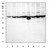Western blot testing of human 1) A431, 2) HeLa, 3) 293T, 4) MOLT-4, 5) Jurkat, 6) A549, 7) MCF7 and 8) U-251 cell lysate with TCP1 alpha antibody. Expected molecular weight ~60 kDa.