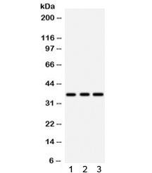 Western blot testing of 1) rat brain, 2) rat liver, and 3) human placenta lysate with IGFBP2 antibody. Predicted/observed molecular weight ~36 kDa.