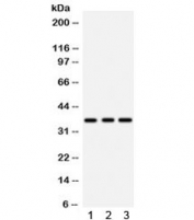 Western blot testing of 1) rat brain, 2) rat liver, and 3) human placenta lysate with IGFBP2 antibody. Predicted/observed molecular weight ~35 kDa.