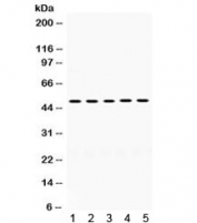 Western blot testing of human 1) HT1080, 2) MCF7, 3) 293, 4) HepG2 and 5) HeLa cell lysate with SDC1 antibody. Expected molecular weight: 32-95 kDa depending on glycosylation level.