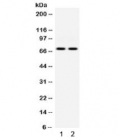 Western blot testing of 1) human HeLa and 2) human A549 cell lysate with PKR antibody. Predicted molecular weight ~62 kDa but routinely observed at 68-72 kDa.