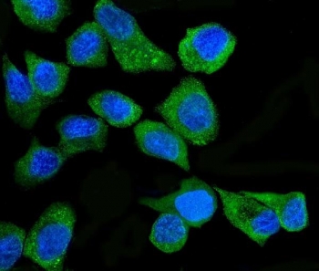 Immunofluorescent staining of FFPE human A431 cells with PKR antibody (green) and DAPI nuclear stain (blue). HIER: steam section in pH6 citrate buffer for 20 min.~
