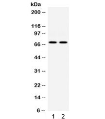 Western blot testing of 1) human HeLa and 2) human A549 cell lysate with PKR antibo