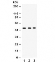 Western blot testing of 1) rat brain, 2) human SW620 and 3) A549 lysate with FUT1 antibody. Predicted/observed molecular weight ~50 kDa.
