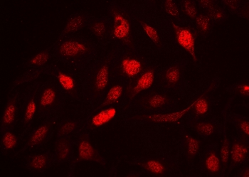 Immunofluorescent staining of FFPE human U-2 OS cells with Cyclin A2 antibody at 2ug/ml. HIER: steam section in pH6 citrate buffer for 20 min.