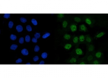 Immunofluorescent staining of FFPE human A431 cells with Cyclin A2 antibody (green) and DAPI nuclear stain (blue). HIER: steam section in pH6 citrate buffer for 20 min.