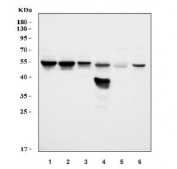 Western blot testing of 1) human K562, 2) human HL60, 3) human MCF7, 4) rat stomach, 5) rat testis and 6) mouse stomach tissue lysate with Cyclin A2 antibody. Expected molecular weight ~49 kDa.