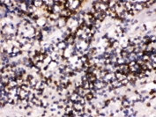 IHC testing of FFPE human tonsil wtih CD22 antibody. HIER: Boil the paraffin sections in pH 6, 10mM citrate buffer for 20 minutes and allow to cool prior to staining.