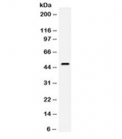 Western blot testing of mouse lung lysate with CD142 antibody. Expected molecular weight ~33/45-50 kDa (unmodified/glycosylated).