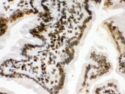 IHC testing of FFPE mouse intestine with LMNB1 antibody. HIER: Boil the paraffin sections in pH 6, 10mM citrate buffer for 20 minutes and allow to cool prior to staining.