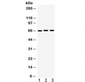Western blot testing of 1) human U87, 2) rat PC-12 and 3) mouse NIH3T3 lysate with LMNB1 antibody. Predicted molecular weight ~66 kDa.